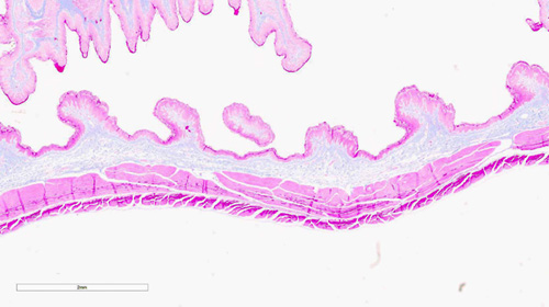 Pincha enlace para ver pliegues constituidos por epitelio de la mucosa y tejido conjuntivo de la submucosa